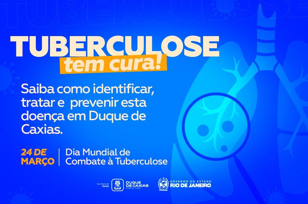 Duque de Caxias faz ações de combate à tuberculose em unidades de saúde