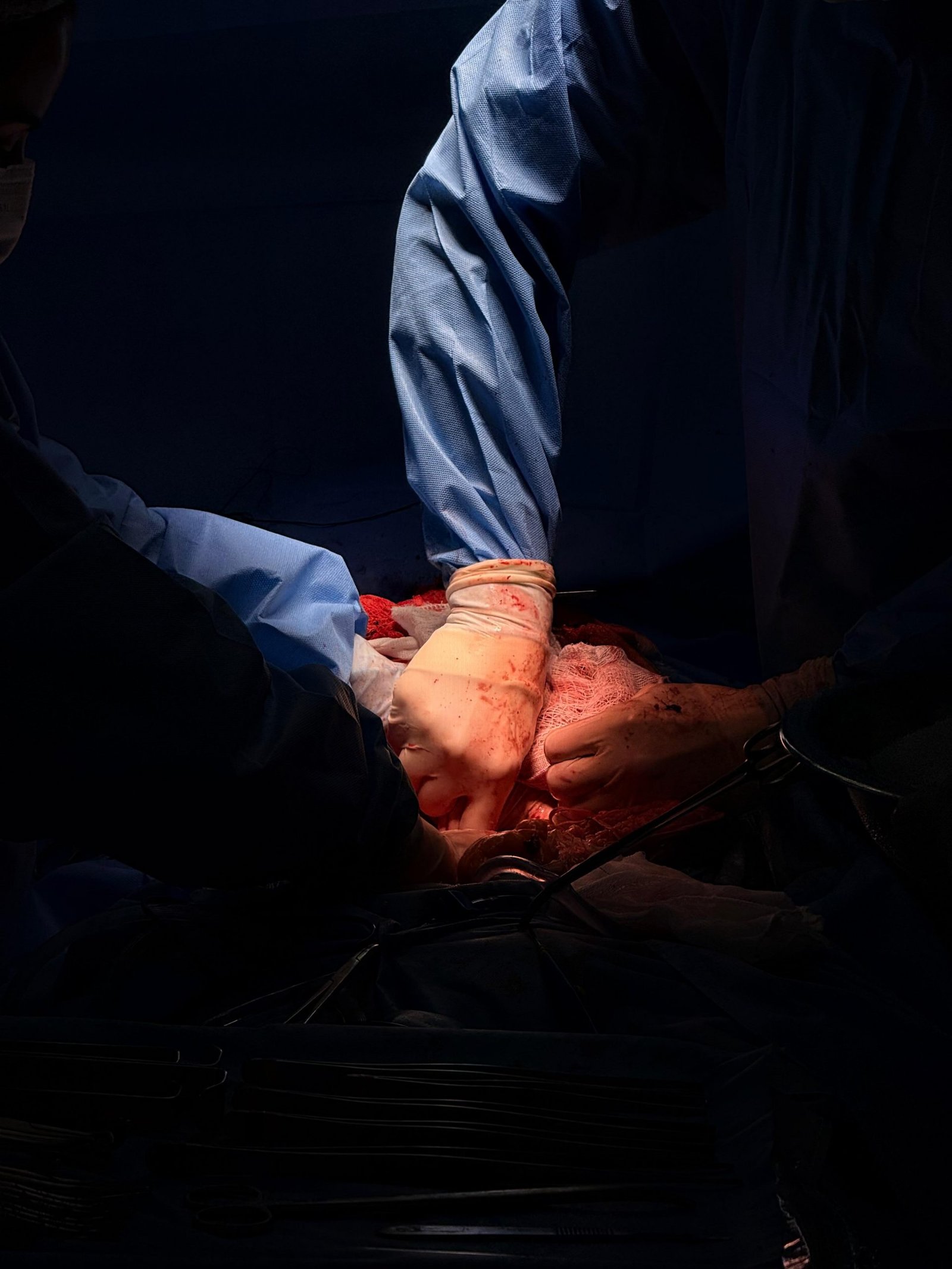 Maricá faz captação de órgãos e tecidos para pacientes na fila de transplantes do SUS